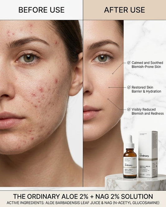 The Ordinary Aloe 2% + NAG 2% Solution
