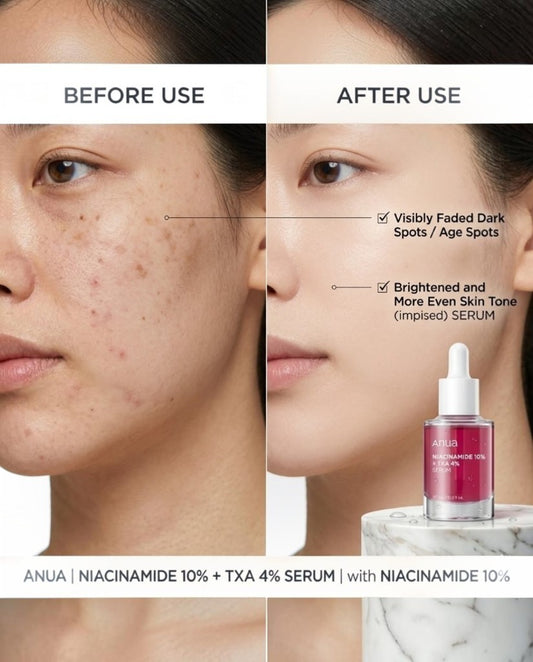 Anua Niacinamide 10% + Txa 4% Serum