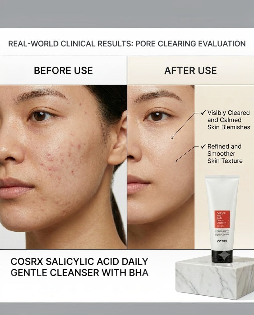 Cosrx Salicylic Acid Daily Face Cleanser