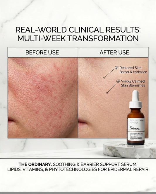 The Ordinary Soothing & Barrier Support Serum