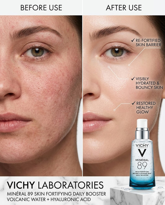 Vichy Mineral 89 Skin Fortifying Daily Booster