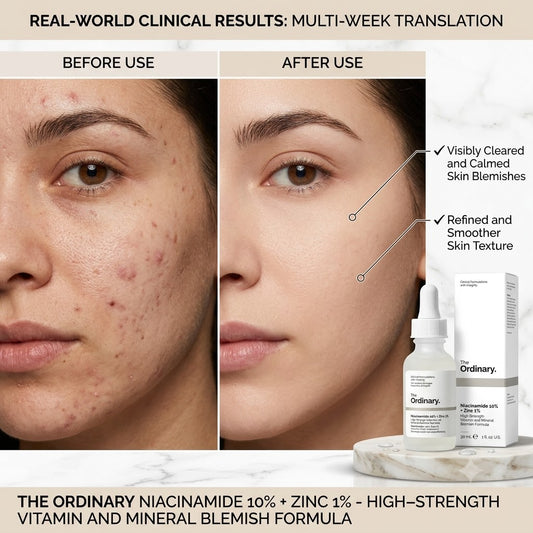 THE ORDINARY NIACINAMIDE 10% + ZINC 1% SERUM FOR ALL SKIN TYPES
