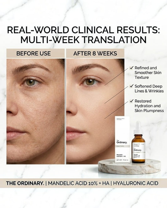 THE ORDINARY MANDELIC ACID 10% + HA - 30ML
