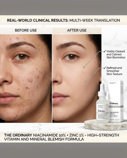 THE ORDINARY NIACINAMIDE 10% + ZINC 1% SERUM FOR ALL SKIN TYPES