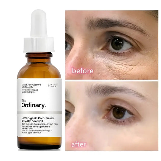 The Ordinary 100% Cold-Pressed Rose Hip Seed Oil - skincare