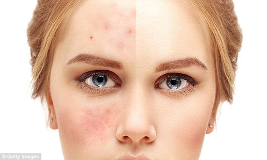 Sensitive Skin Survival Guide . Ingredients to Avoid What to Use Instead