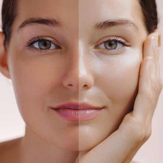 Unlock Radiant Beauty: Your Guide to Skin Whitening and Glowing Skin