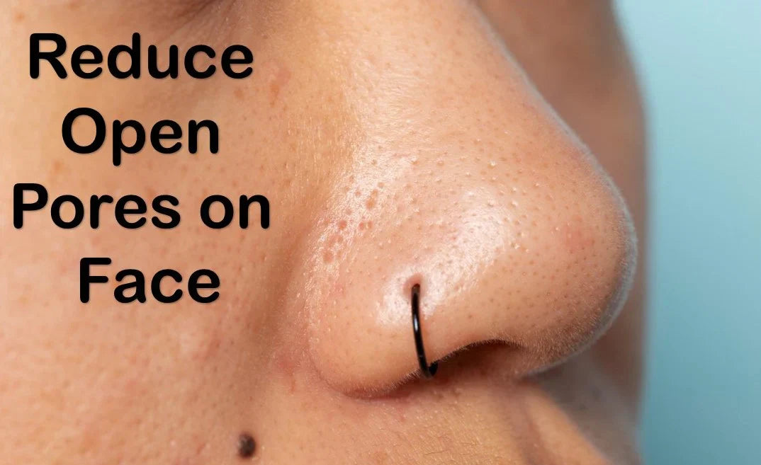 how to reduce open pores 