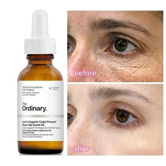 The Ordinary cold pressed rose hip seed oil