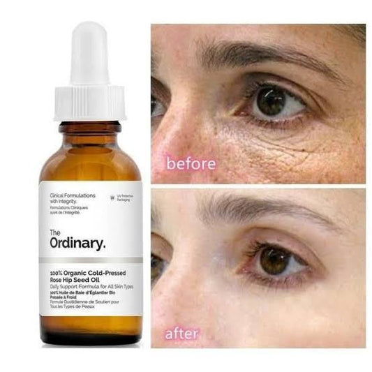 The Ordinary cold pressed rose hip seed oil