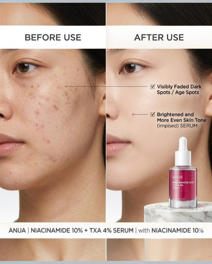 Anua Niacinamide Dark Spot Correcting Serum