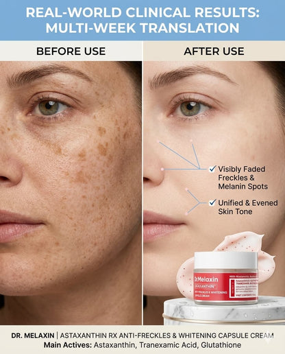 Dr.Melaxin Anti Reckle & Whitening Capsule Cream