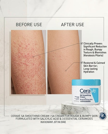 CeraVe SA SMOOTHING CREAM 340G Made In USA