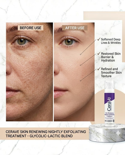 CeraVe Skin Renewing Nightly Treatment 50ml – Fights Wrinkles, Restores Radiance, Boosts Overnight Repair