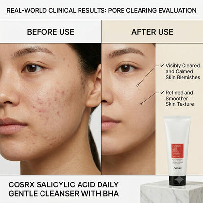 Cosrx Salicylic Acid Daily Face Cleanser