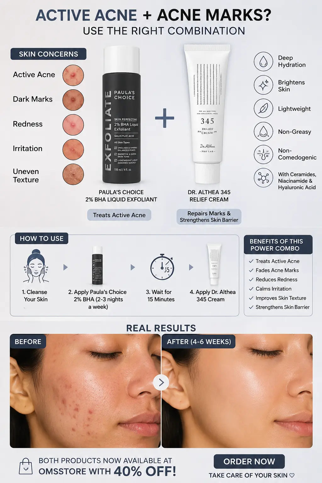 Acne & Marks Treatment Solution Discounted Combo Deal