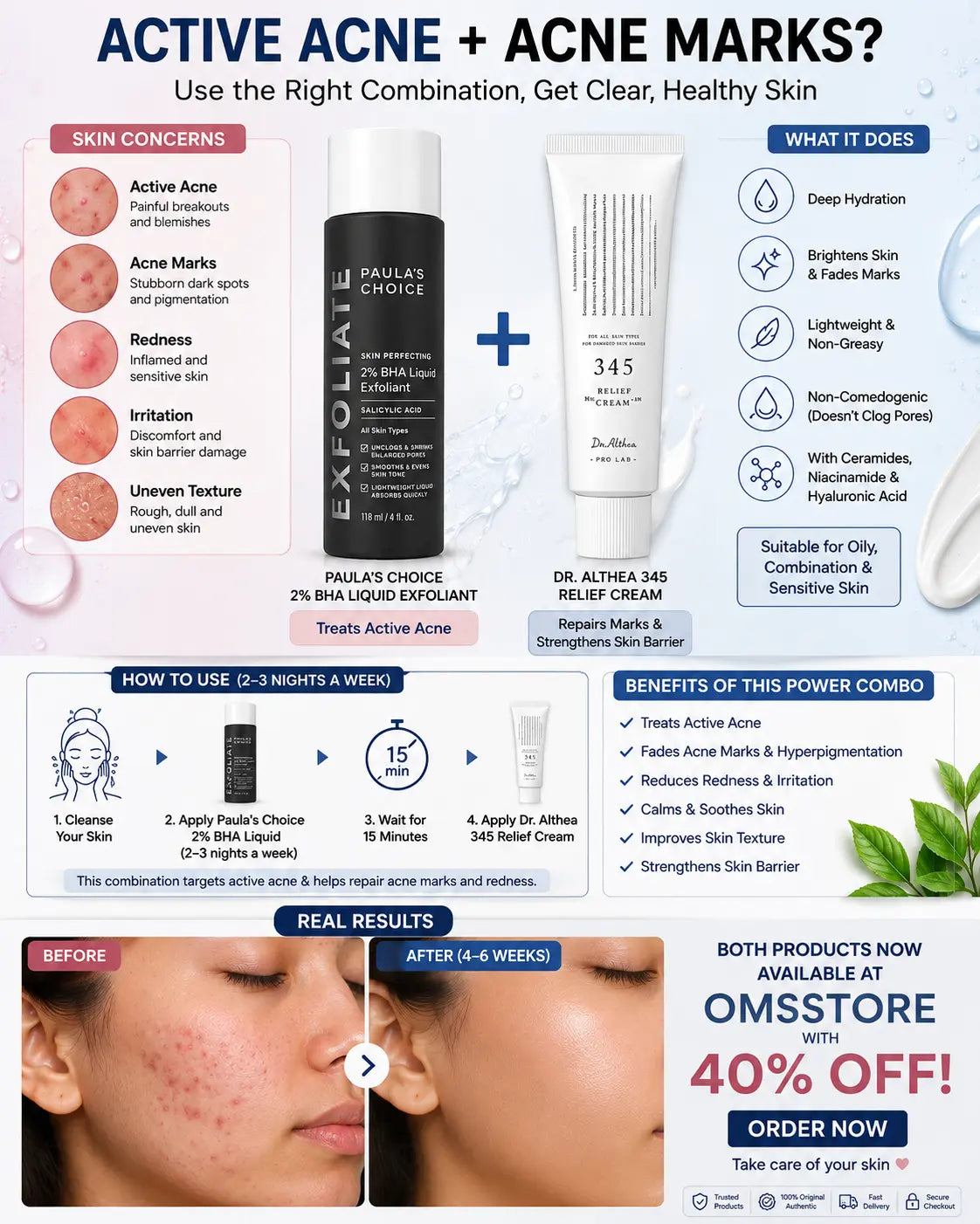 Acne & Marks Treatment Solution Discounted Combo Deal