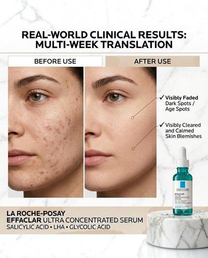 LA Roche Effaclar Ultra Concentrated Serum