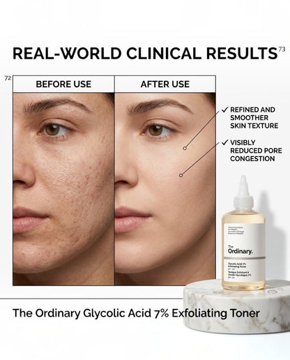 The Ordinary Glycolic Acid 7% Exfoliating Toner