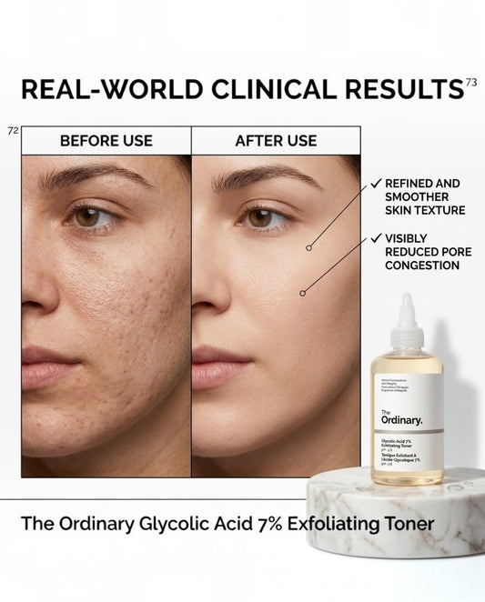 The Ordinary Glycolic Acid 7% Exfoliating Toner