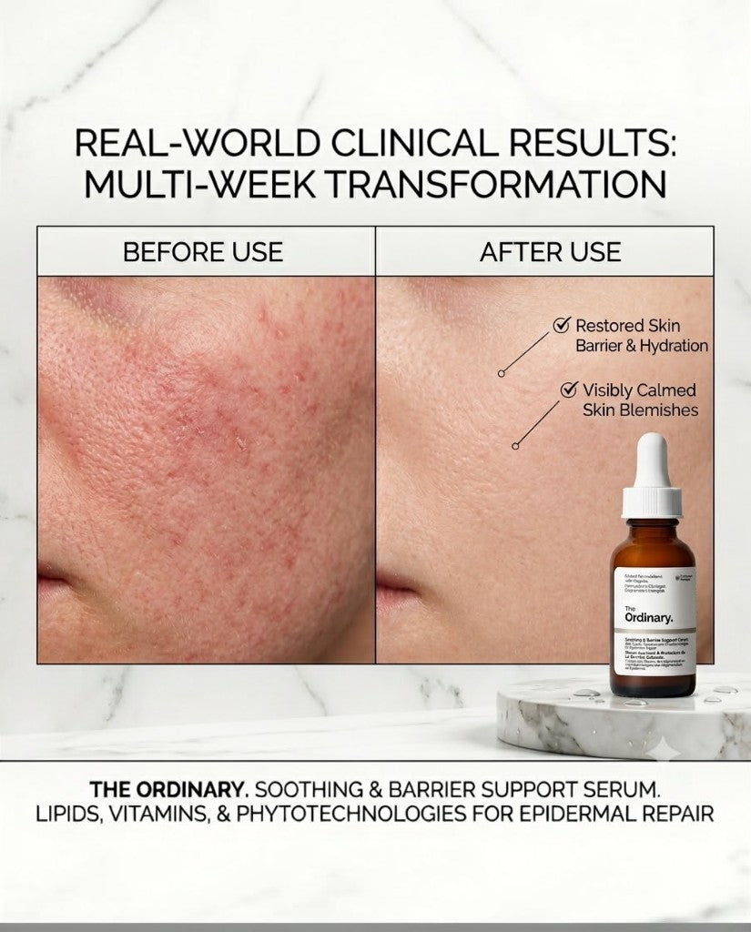 The Ordinary Soothing & Barrier Support Serum