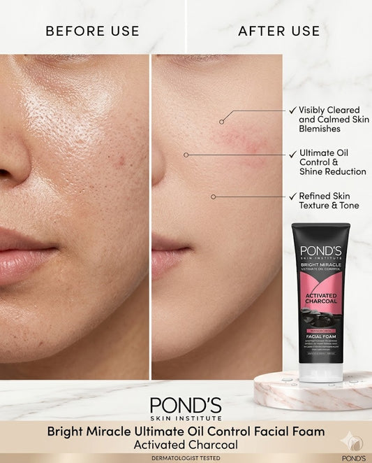 Pond's Bright Activated Charcoal Miracle Facial Foam