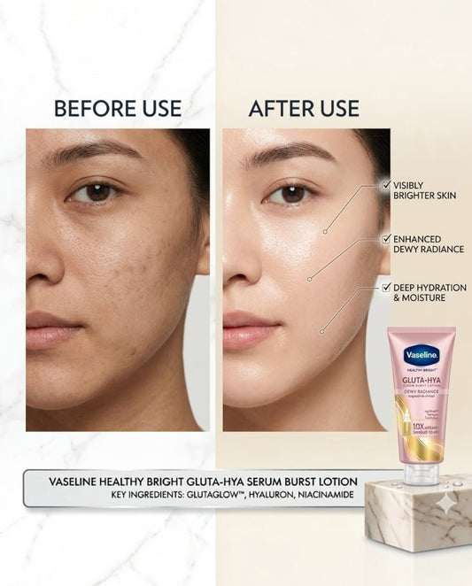 Vaseline GLUTA-HYA Dewy Radiance 300 ml