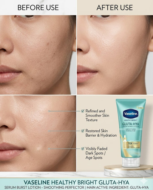 Vaseline GLUTA-HYA Serum Burst Lotion Smoothing Perfector 300 ml