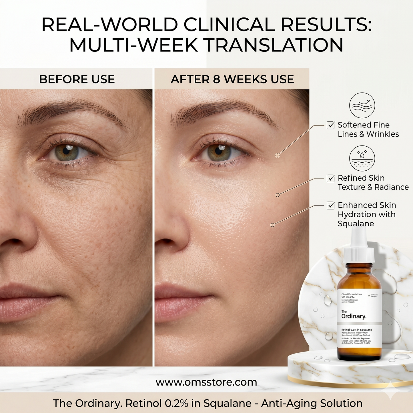 THE ORDINARY RETINOL 0.2% IN SQUALANE