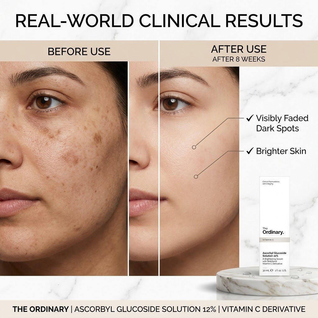 THE ORDINARY ASCORBYL GLUCOSIDE SOLUTION 12%