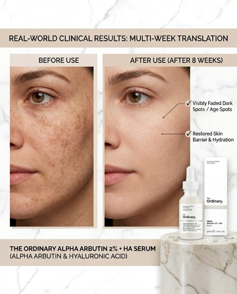 The Ordinary Alpha Arbutin Serum 2% + Ha 30Ml