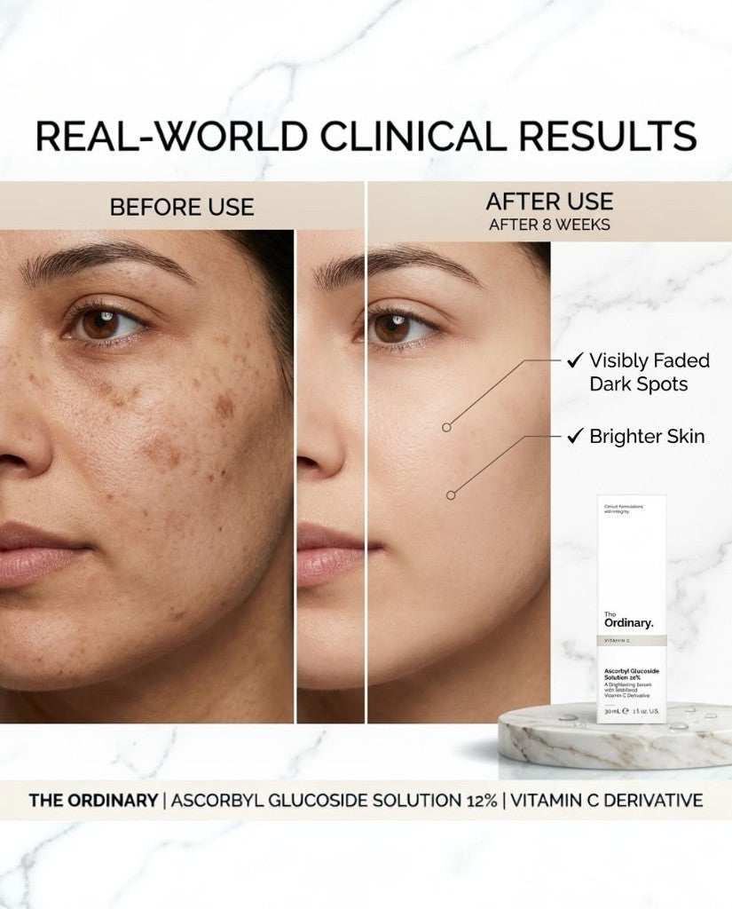 THE ORDINARY ASCORBYL GLUCOSIDE SOLUTION 12%