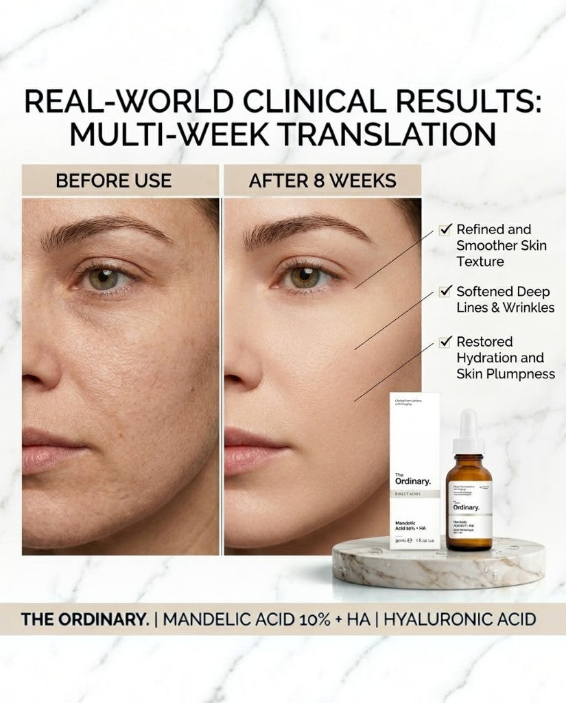 THE ORDINARY MANDELIC ACID 10% + HA - 30ML